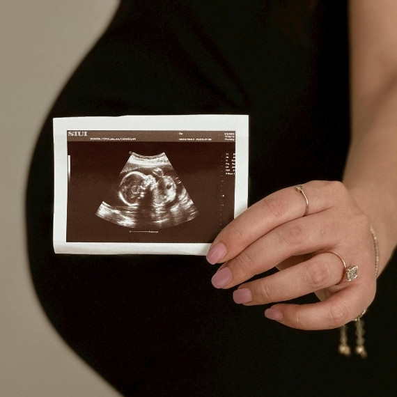 infertility-bump-scan A pregnant woman holding up her baby scan image, with her bump in the background, after having gone through Samantha's Infertility Support & Fertility Coaching Programme